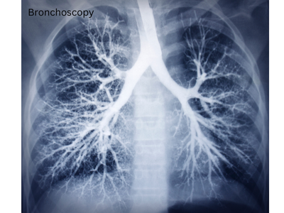 Best Doctor for Bronchoscopy in Ghatkopar