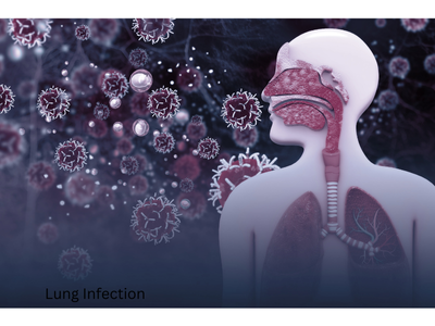 Best Lung Infection Treatment in Ghatkopar